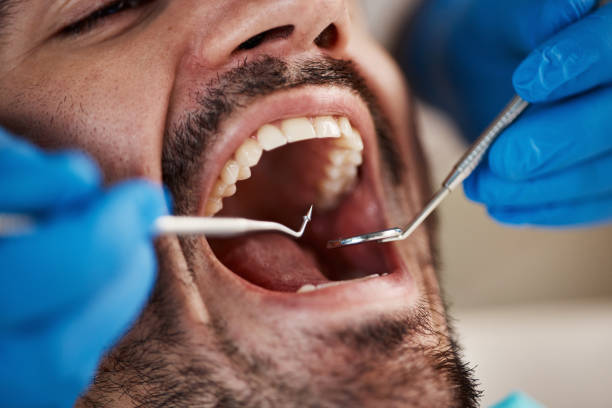 Best Emergency Cosmetic Dentistry (e.g., broken veneers) in Sparks, TX